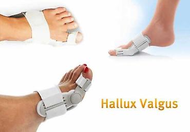Вальгус шиналары: Ортопедическая шина hallufix адрес: лермонтова — 6