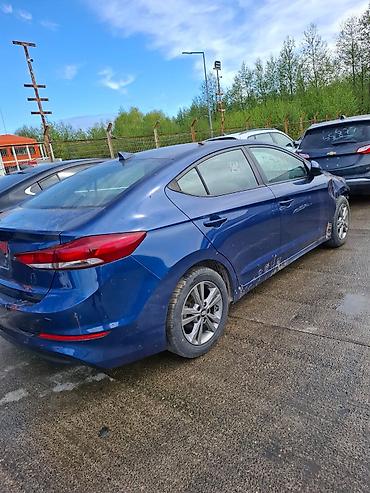 elantra difuzer: Bakıda hazır Rengsaz sexı bıznes kımı satılır 500mnaata sex qesey — 2