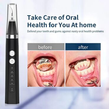 электронная зубная щётка: Портативный Ультразвуковой очиститель для удаления зубного камня