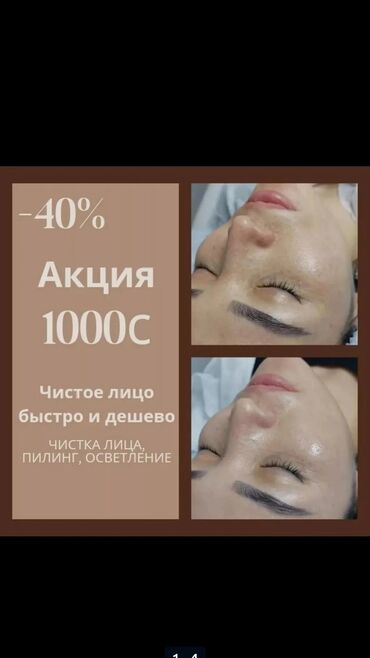 Косметология: Косметолог с медицинским образованием чистка лица пилинг осветление — 11