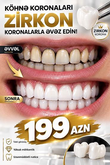 Tibb bacıları: Tibb bacısı tələb olunur, 18-29 yaş, 1-2 illik təcrübə, 6/1 — 1