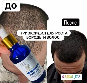 lenovo tab2 a10 30: Триоксидил для роста бороды и волос. В комплекте пипетка. Использовать