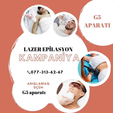 laser epilator qiymeti: Lazer epilyatoru