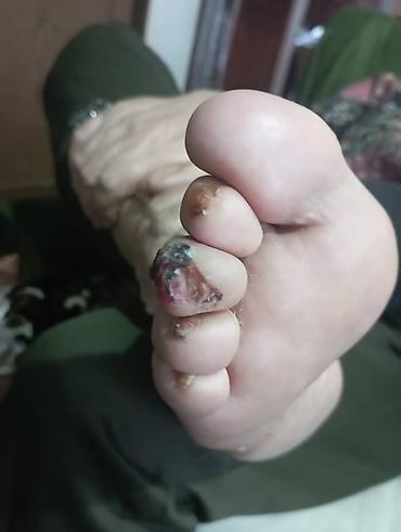 Маникюр: Коррекция вросших ногтей, Педикюр, Услуги подолога, Консультация, Одноразовые расходные материалы — 8