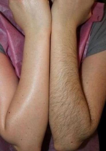 Эпиляция: Восковая депиляция для женщин и мужчин Подмышки - 500 сом — 1