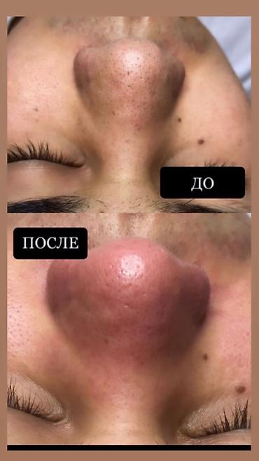 Сулуулук жана ден-соолук: ✨ Косметолог из Москвы теперь в Бишкеке! ✨ Опыт работы 5 лет — 6