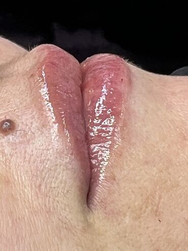 Косметология: Косметология, Маски, Мезотерапия, Удаление носогубных складок, Гипоаллергенные материалы, Консультация, Сертифицированный косметолог — 65