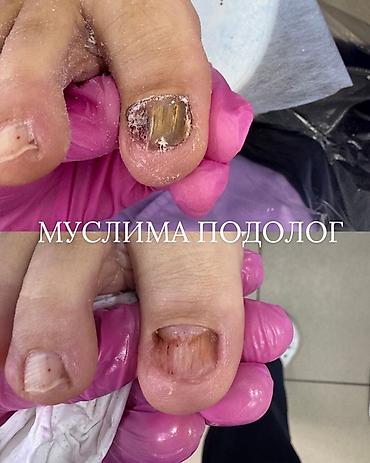 дезинфектор: Подологические услуги Специалист: Муслима — подолог. Направления — 10