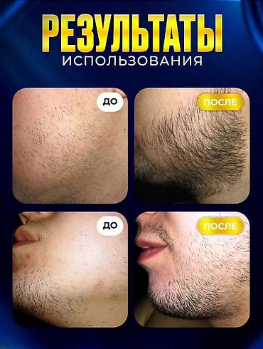 Другие медицинские товары: Усиленный бустер для роста волос и бороды VIKINORD Element Booster 15% — 3