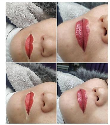 Косметология: Косметология, Ботокс, Биоревитализация, Ботулинотерапия, С выездом на дом, Консультация, Гипоаллергенные материалы — 24