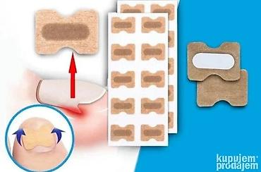 resama: Flasteri za urasle nokte – korektivne trakice za podizanje ivica nokta — 1