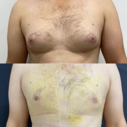 Digər gözəllik və estetika cihazları: Plastik estetik hər yüksək səviyyə uyğun qiymət!!!Burdan mesaj — 12