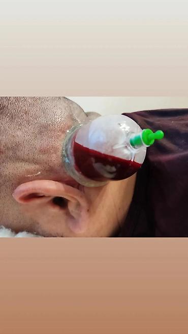 ereb azerbaycan tercume: Müalicəvi masaj, Kişilər üçün, Qadınlar üçün, Evə gəlməklə — 7