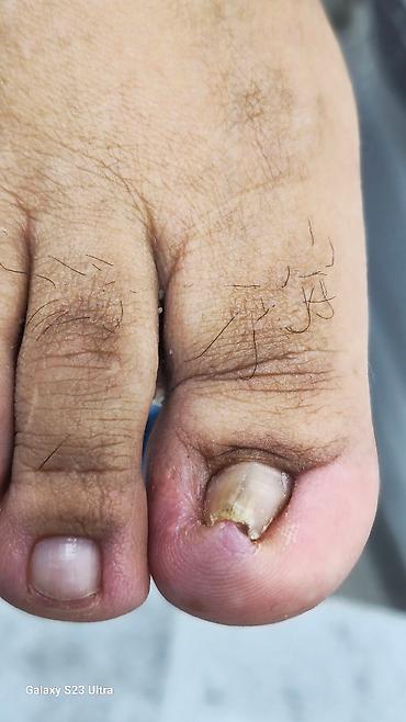 Маникюр: Коррекция вросших ногтей, Услуги подолога, Консультация — 8