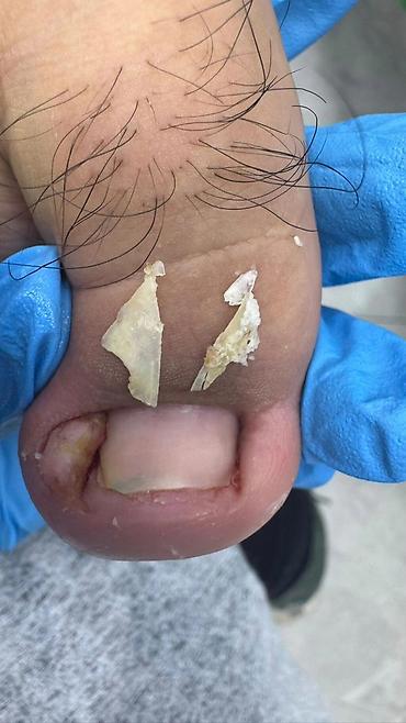 Маникюр: Коррекция вросших ногтей, Маникюр, Педикюр, Услуги подолога, С выездом на дом, Консультация, Одноразовые расходные материалы — 22