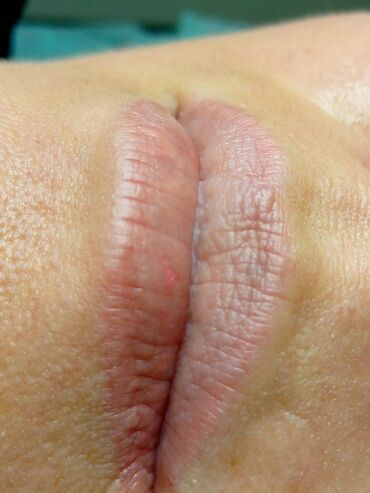 Косметология: Косметология, Биоревитализация, Ботулинотерапия, Контурное моделирование, Гипоаллергенные материалы, Консультация, Сертифицированный косметолог — 28