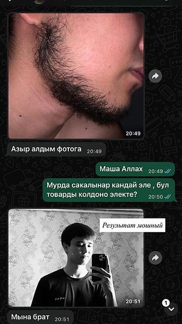 щеки: Миноксидил 5% для роста бороды + массажный дермароллер (указан как — 8