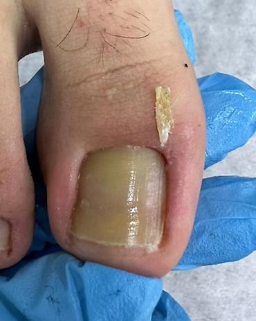 Маникюр: Ремонт сломаных ногтей, Наращивание ногтей, Донаращивание ногтей, Услуги подолога, Маникюр, Педикюр, Консультация, Одноразовые расходные материалы — 8