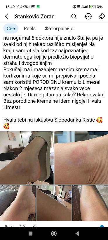 Ortopedski dušeci i jastuci: Limes proizvodi Porudzbine,saradnja postani moj kupac,saradnik — 176