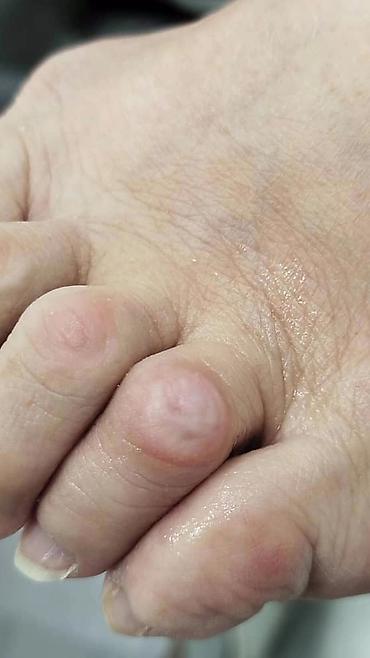 Маникюр: Коррекция вросших ногтей, Услуги подолога, Консультация — 7