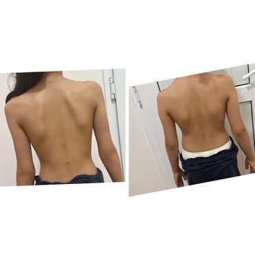 Masaj: Vakuum masajı, Qadınlar üçün — 9