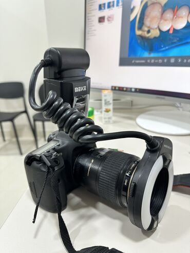 фотоаппарат canon 7d: Canon EOS 7D Macro 100 mm Для дентального фото . Комплект : кольцевая