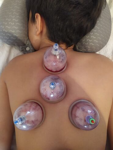 Hicama, zəli: Hicama, quru və yaş vakuum masajı, həmçinin zəli ilə müalicə xidməti — 2