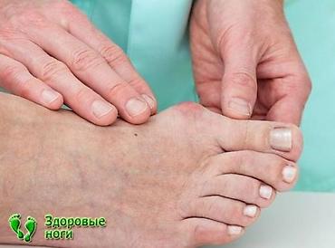 Женская обувь: Корректоры для ношения с обувью Корректоры от косточки на ноге! — 2