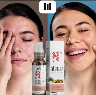 Kozmetika: ✨ aknelim pelle pulita gel✨ ☘️ umiruje kožu ☘️ koža ostaje hidrirana
