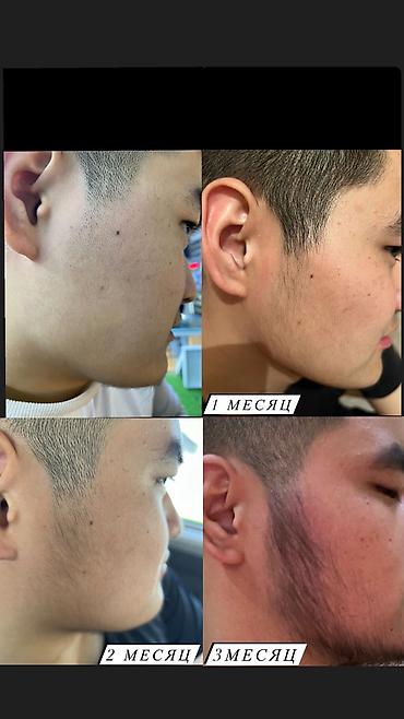 Уход за телом: Рост борода и волосы Миноксидил ультра 15% оригинал✅из Турции🇹🇷 — 12