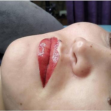 Косметология: Косметология, Ботокс, Биоревитализация, Ботулинотерапия, С выездом на дом, Консультация, Гипоаллергенные материалы — 25