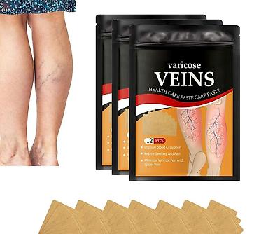 jastuče za hemoroide: Flasteri za proširene vene – Varicose Veins Health Care Paste - — 2