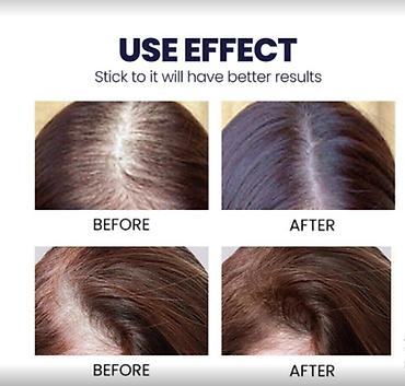 Уход за телом: США Блюстом от облысения и потери волос Читаем объявление смотрим — 2