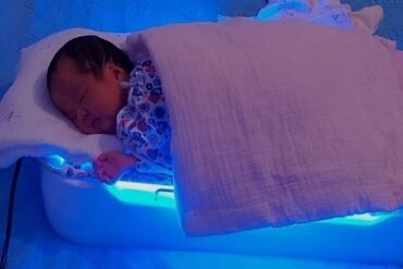 лампа для лечения желтухи новорожденных: Фотолампа (люлька) Облучатель фото терапевтический для лечения желтухи