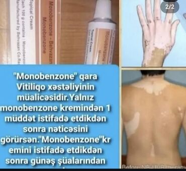 апсайз крем в душанбе: Məhsul: İran🇮🇷 istehsali Monobenzone – Behvazan 20% (topikal krem) at lalafo.az апсайз крем в душанбе: Məhsul: İran🇮🇷 istehsali Monobenzone – Behvazan 20% (topikal krem)