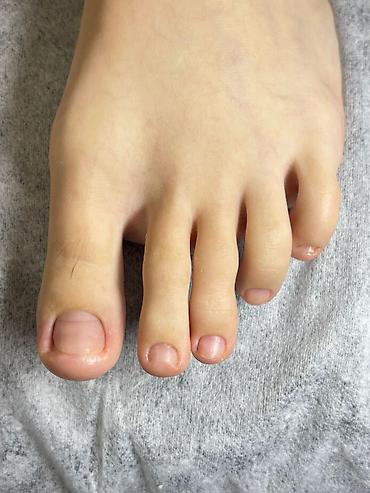 Маникюр, педикюр: Коррекция вросших ногтей, Услуги подолога, С выездом на дом, Консультация, Одноразовые расходные материалы — 13