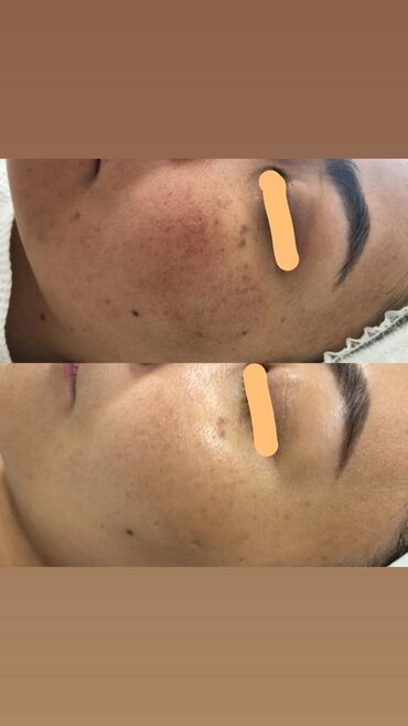 Косметология: Косметология, Чистка кожи, Биоревитализация, Пилинг, Сертифицированный косметолог, Гипоаллергенные материалы, Консультация — 9