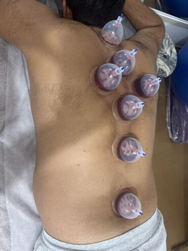 Hicama, zəli: Xidmət: Kupa terapiyası (quru və yaş/hicama), bel–boyun–çiyin masajı — 3