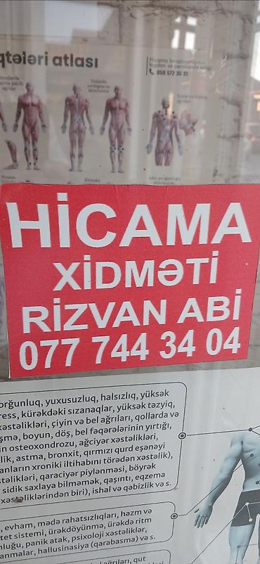 Hicama, zəli: HİCAMA EDİRƏM 30 AZN bankalar 1 dəfəlikdir sonra atilir 1 seansa 7 — 5
