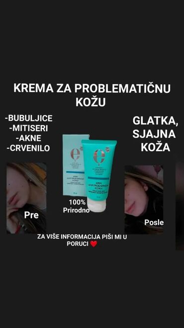 Nega kože: Experalta kozmetika – nega za problematičnu i zrelu kožu - Krema za — 1