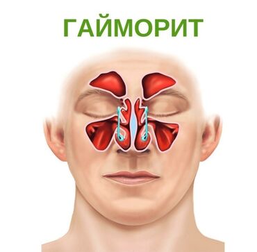 массаж детям: Массаж | Спортивный, Эндермологический, Лимфодренажный | Остеохондроз, Межпозвоночная грыжа, Протрузия