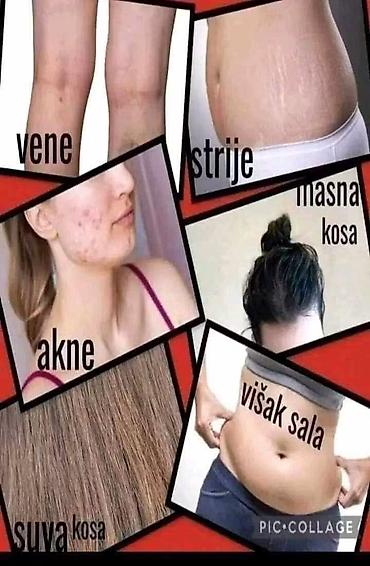 Kućna hemija i proizvodi za kuću: Limes “Selekta” – set za blistavo domaćinstvo Sadržaj i namena: - — 33