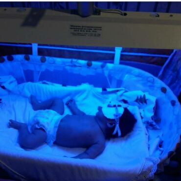 лампа для лечения желтухи новорожденных: Закажите у нас фотолампу измерение билирубина билитестом бесплатно !