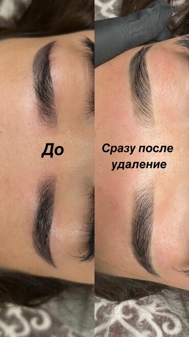 Перманентный макияж: АКЦИЯ !АКЦИЯ! Новый метод удаления Сейчас по акции Лазерное удаление — 11