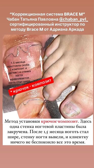 Маникюр, педикюр: Ремонт сломаных ногтей, Снятие, Укрепление ногтей, Услуги подолога, Одноразовые расходные материалы, Консультация, С выездом на дом — 9