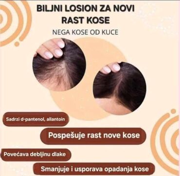 Nega kose: KosaLim 💚 Kosalim je kombinacija prirodnih ekstrakta lekovitog bilja na lalafo.rs — 8 Nega kose: KosaLim 💚 Kosalim je kombinacija prirodnih ekstrakta lekovitog bilja — 8