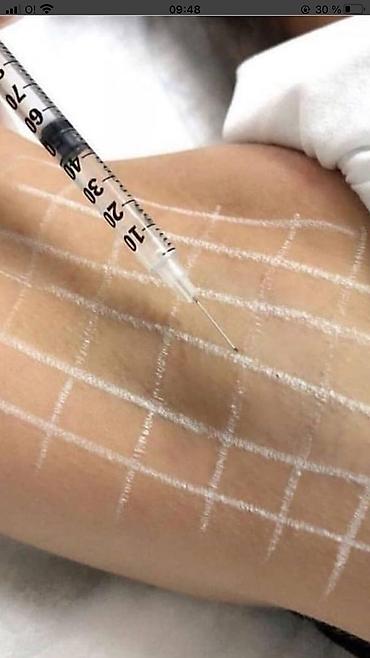 Косметология: Косметология, Брыли, Ботокс, Биоревитализация, Консультация, Гипоаллергенные материалы, Сертифицированный косметолог — 15