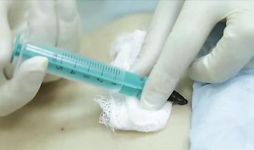 Другие медицинские товары: Медицинские пиявки (Hirudo medicinalis) — для гирудотерапии и — 2