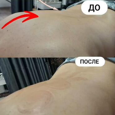услуги лечебного массажа: Массаж | Лечебный массаж | Остеохондроз, Протрузия, Кифос, лордоз | С выездом на дом