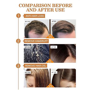 Уход за телом: ❄️ США имбирный шампунь против алопеции шампунь против облысения — 7